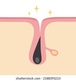 Ilustración de imágenes de poros normales