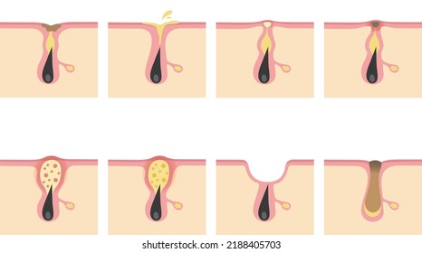 Image illustration of various skin troubles