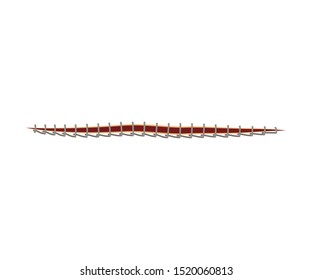 Image Of Lock-Stitch Suture For Wound Isolated On White Background