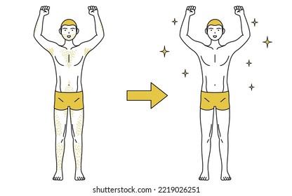 Image of medical hair removal, before-and-after of a man suffering from thick body hair being removed and becoming smooth.