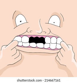 An image of a person with missing teeth.