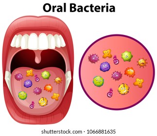 An Image Showing Oral Bacteria illustration