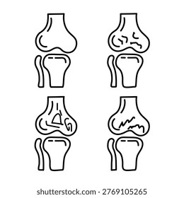 The image shows four diagrams of knee joints, illustrating the differences between a healthy  and various types of knee joint fractures. The top left diagram represents a healthy  joint, while the other three diagrams depict different fracture patterns, including intra-articular fractures and possible ligament damage. These visuals are useful for understanding the structural integrity and potential injuries of the knee joint.