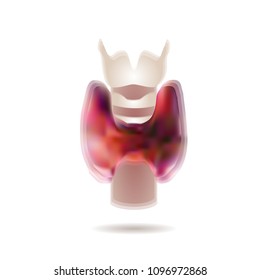 Image of the thyroid gland