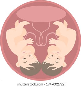image of two identical embryos in the uterine cavity with one placenta.
stock isolated illustration on white background for printing on postcards, websites, shop advertising in cartoon style