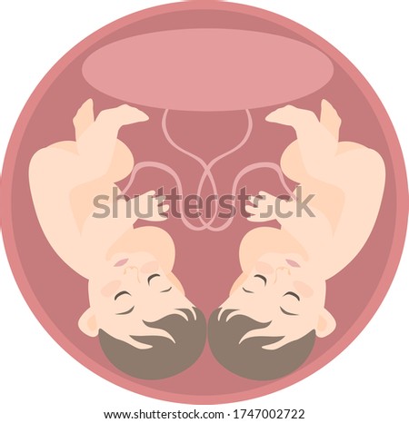 image of two identical embryos in the uterine cavity with one placenta.
stock isolated illustration on white background for printing on postcards, websites, shop advertising in cartoon style
