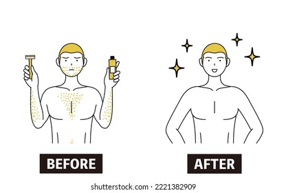 Image of unwanted hair treatment, before-and-after of a man suffering from thick body hair, who becomes more confident after shaving or using hair removal cream.