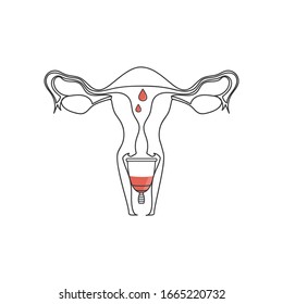 Image of the use of the menstrual cup. Line image of the inside of the uterus with a menstrual cup. Schematic icon.