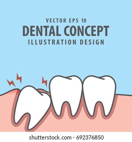 Impacted tooth inside under inflammation gum illustration vector on blue background. Dental concept.