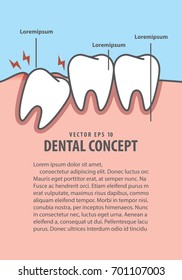 Impacted tooth inside under inflammation gum frame cartoon style for info or book illustration vector on blue background. Dental concept.