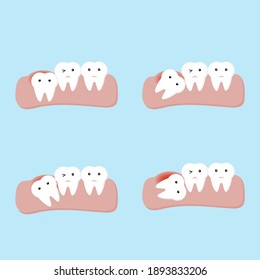 impacted tooth or wisdom teeth dental and oral diseases vector illustration cartoon flat design