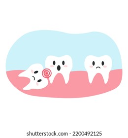 Impacted wisdom tooth in cartoon flat style. Vector illustration of disgruntled teeth characters, dental health concept, oral hygiene