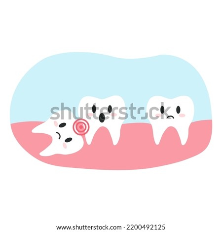 Impacted wisdom tooth in cartoon flat style. Vector illustration of disgruntled teeth characters, dental health concept, oral hygiene