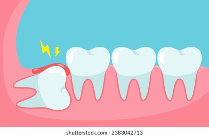 Impacted wisdom tooth cause pain in the mouth.Dental care concept