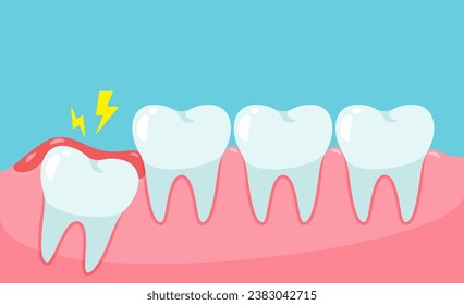 Impacted wisdom tooth cause pain in the mouth.Dental care concept