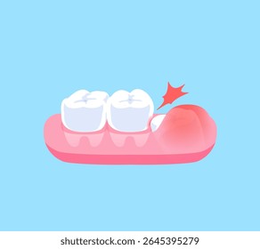 Impacted wisdom tooth illustration vector design. Dental care concept.