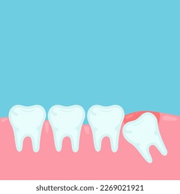 Impacted wisdom tooth. Wisdom tooth under the gum. Toothache. Wisdom tooth removal. Orthodontical concept. Vector