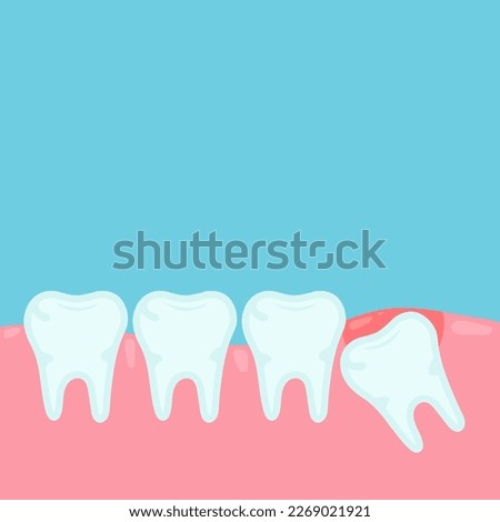 Impacted wisdom tooth. Wisdom tooth under the gum. Toothache. Wisdom tooth removal. Orthodontical concept. Vector