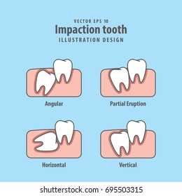 Impaction tooth illustration vector on blue background. Dental concept.