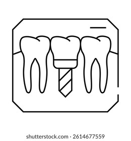 implant check line icon vector. implant check sign. isolated contour symbol black illustration