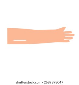 Conceito de contracepção de implante. ilustração vetorial
