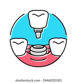 implante de procedimiento dental icono de color Vector. implante de procedimiento dental. ilustración de símbolo aislado