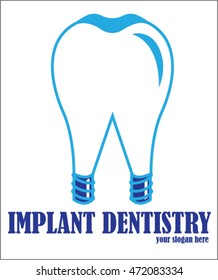 implant dentistry