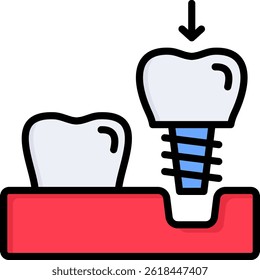Implant Icon Lineal Color Vector Illustration