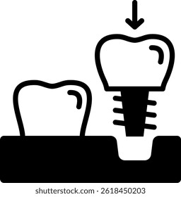 Implant Icon Mixed Vector Illustration
