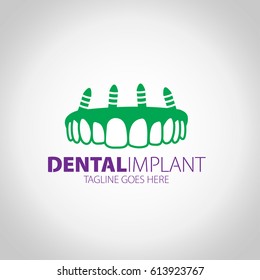 implant logo