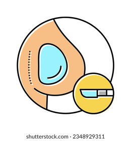 implant surgery color icon vector. implant surgery sign. isolated symbol illustration