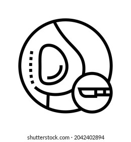 implant surgery line icon vector. implant surgery sign. isolated contour symbol black illustration