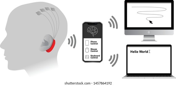 Implantable brain–machine interface with chronic electrode implant, neural-control interface, brain–computer interface.  Communication between brain and external device. Neuroprosthetics. Vector