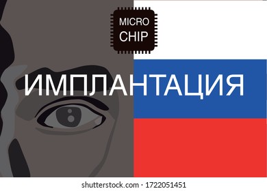 "Implantation" written on Russian language. Launch of use of Personal micro chips in Russia in future. Vector format. 