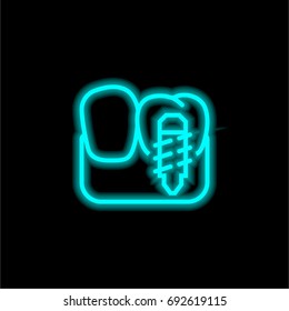 Implants blue glowing neon ui ux icon. Glowing sign logo vector