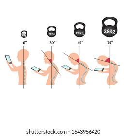 Improper posture symptoms. Stage Text Neck Syndrome. Spinal curvature, kyphosis, lordosis, scoliosis, arthrosis. Improper posture and stoop. Infographics. Vector illustration on isolated background.