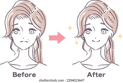 Improvement before and after illustration material for women suffering from nasolabial folds and wrinkles