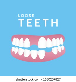 
Incomplete teeth. Loss of teeth. Not beautiful. Teeth have problems, vector, illustration.