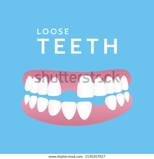 \
Incomplete teeth. Loss of teeth. Not\
beautiful. Teeth have problems, vector,\
illustration.