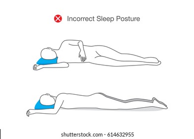 Incorrect Posture While Sleeping. Illustration About Healthy Lifestyle.