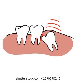 Incorrect teething doodle icon, Doodle tooth, teeth and tooth concept of dental. 
Vector illustration on a white background.