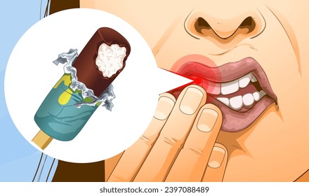 Increased dental sensitivity. Toothache. Sharp pain when  eating cold foods. Healthcare illustration, Vector illustration. 