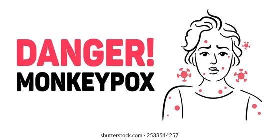 Increasing Awareness of Monkeypox Essential Health Precautions and Recognizing Symptoms. An educational graphic highlighting monkeypox symptoms and dangers to raise public awareness effectively