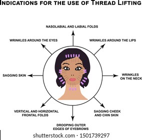 Indications for the use of thread lifting. Mesotherapy Wrinkles. Infographics. Vector illustration on isolated background.