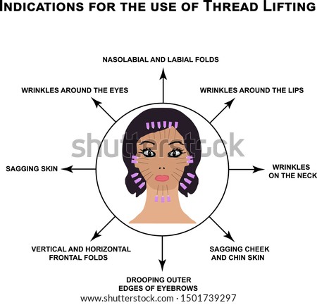 Indications for the use of thread lifting. Mesotherapy Wrinkles. Infographics. Vector illustration on isolated background.