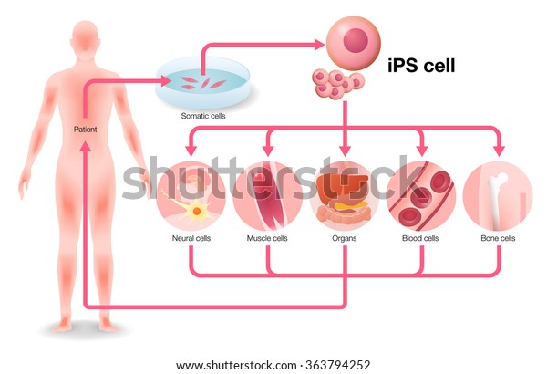 Ips細胞 Ips細胞 と再生医療 ベクターイラスト のベクター画像素材 ロイヤリティフリー