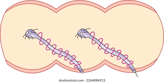 Inefrudiums in the earthworm vector