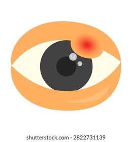 Infected eye concept. eyes conjunctivitis