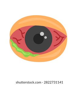 Infected eye concept. eyes conjunctivitis