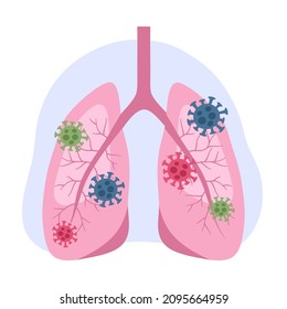 Ilustración vectorial del concepto pulmonar humano infectado. Anatomía de pulmones humanos con virus en diseño plano sobre fondo blanco. Neumonía.